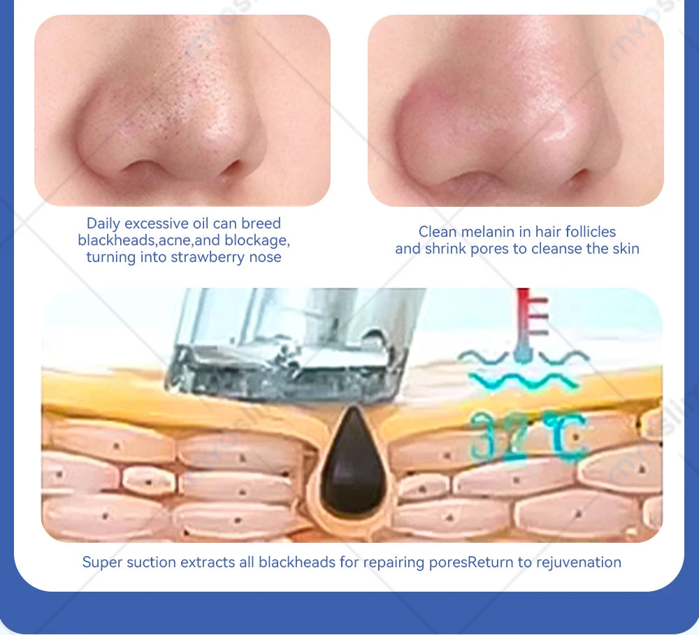 Oxygen Skin Moisturizing Beauty Machine Hydrodermabrasion Water Peeling Deep Cleansing Exfoliation Beauty Facial Device