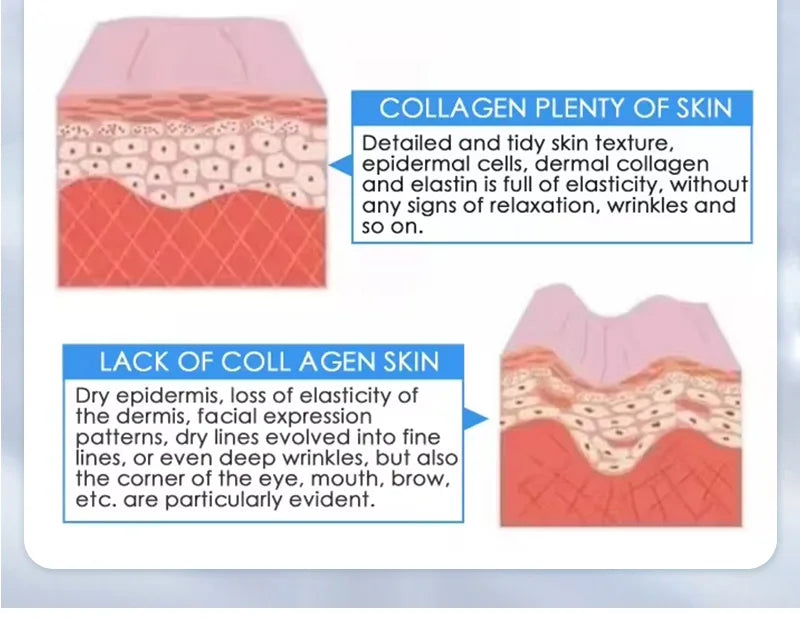 NEO Equipment Slimming Ultrasound Cellulite Wrinkle Removal Face Lift 2 Handles Ultra 360 Fat Reducing Machine For Salon