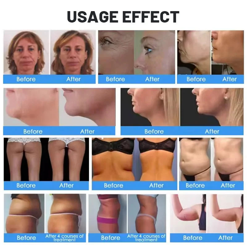 NEO Equipment Slimming Ultrasound Cellulite Wrinkle Removal Face Lift 2 Handles Ultra 360 Fat Reducing Machine For Salon